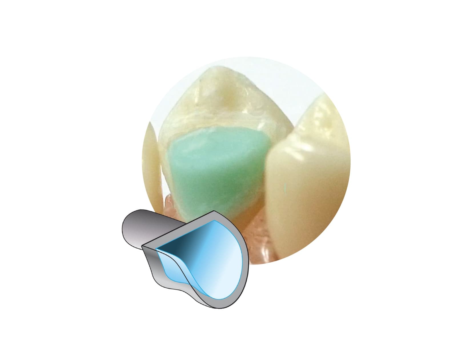 Attachements Mini Mold – rampes de surélévation Canine