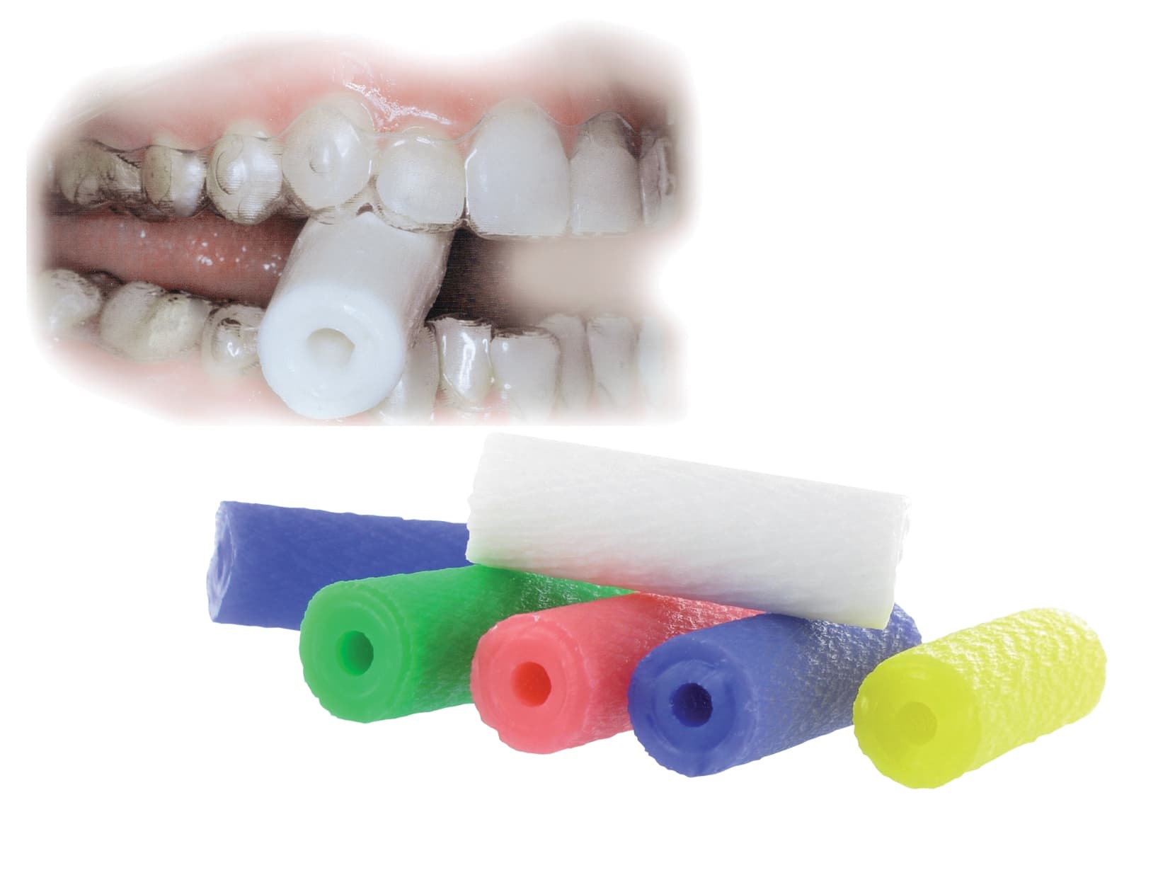 Aligner Chewies- de DENTSPLY SIRONA